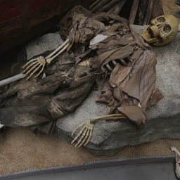 [lochal97] Squelette amputé - 200cm